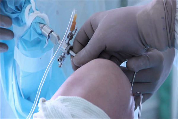 Trauma Surgery