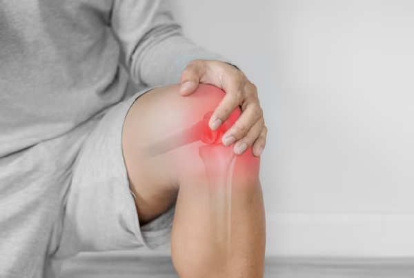 Knee Replacement Surgery
